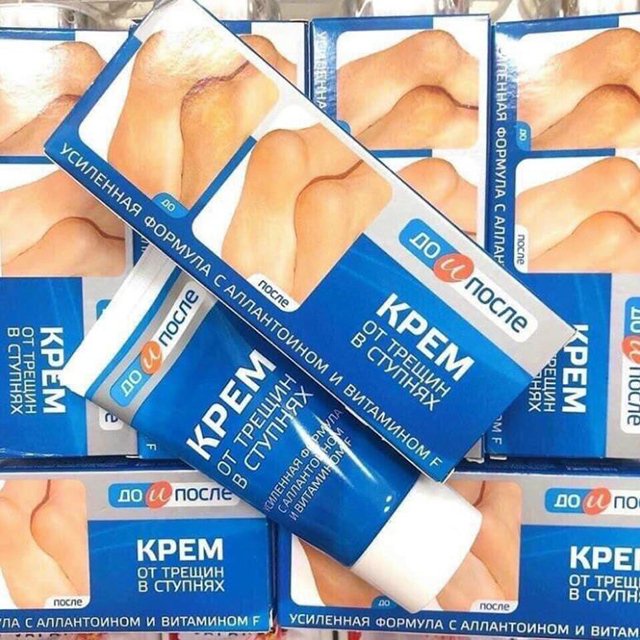 Kem Dưỡng Gót Chân Kpem Ngăn Ngừa Và Hồi Phục Nứt Nẻ - Chính Hãng Nga 50ml