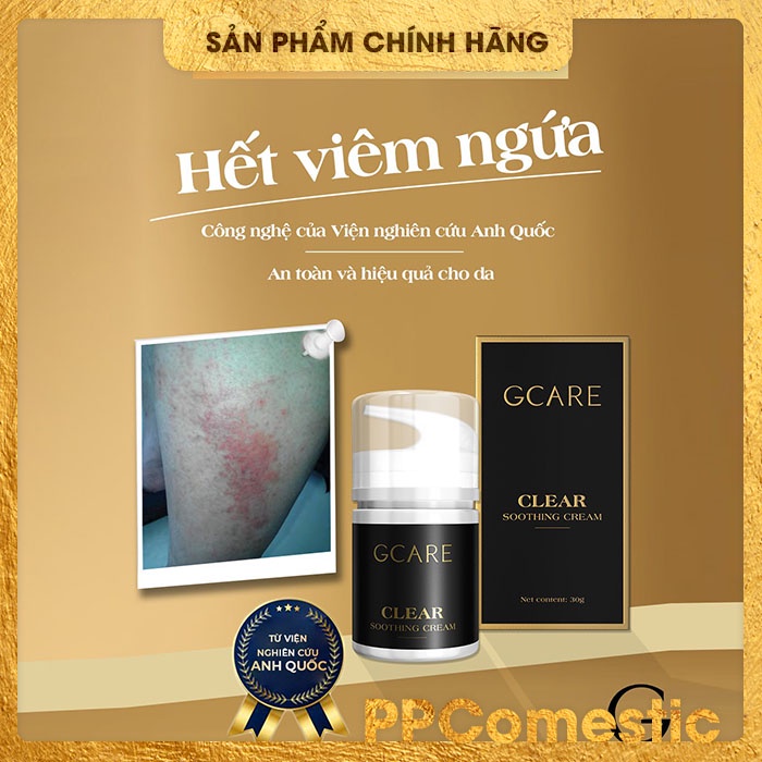 KEM GCARE SOOTHING CREAM 30g - ĐÁNH BAY VIÊM DA, MẪN NGỨA, VÃY, MỀ ĐAY | BigBuy360 - bigbuy360.vn
