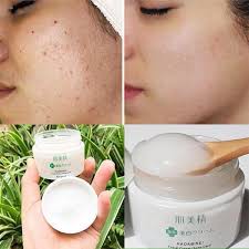 Kem mụn kracie | BigBuy360 - bigbuy360.vn