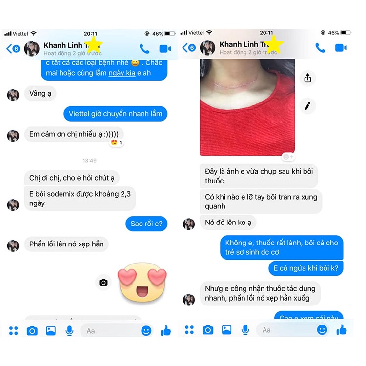 SODERMIX® Kem Bôi Sẹo Lồi, Sẹo Thâm, Sẹo Phì Đại - Nhập Khẩu Nguyên Hộp Từ Pháp - Hàng Chính Hãng