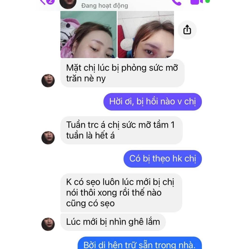 Mỡ trăn nguyên chất N'store chính hãng mờ rạn da, triệt lông vĩnh viễn tay, chân, nách, bikini an toàn,... | BigBuy360 - bigbuy360.vn