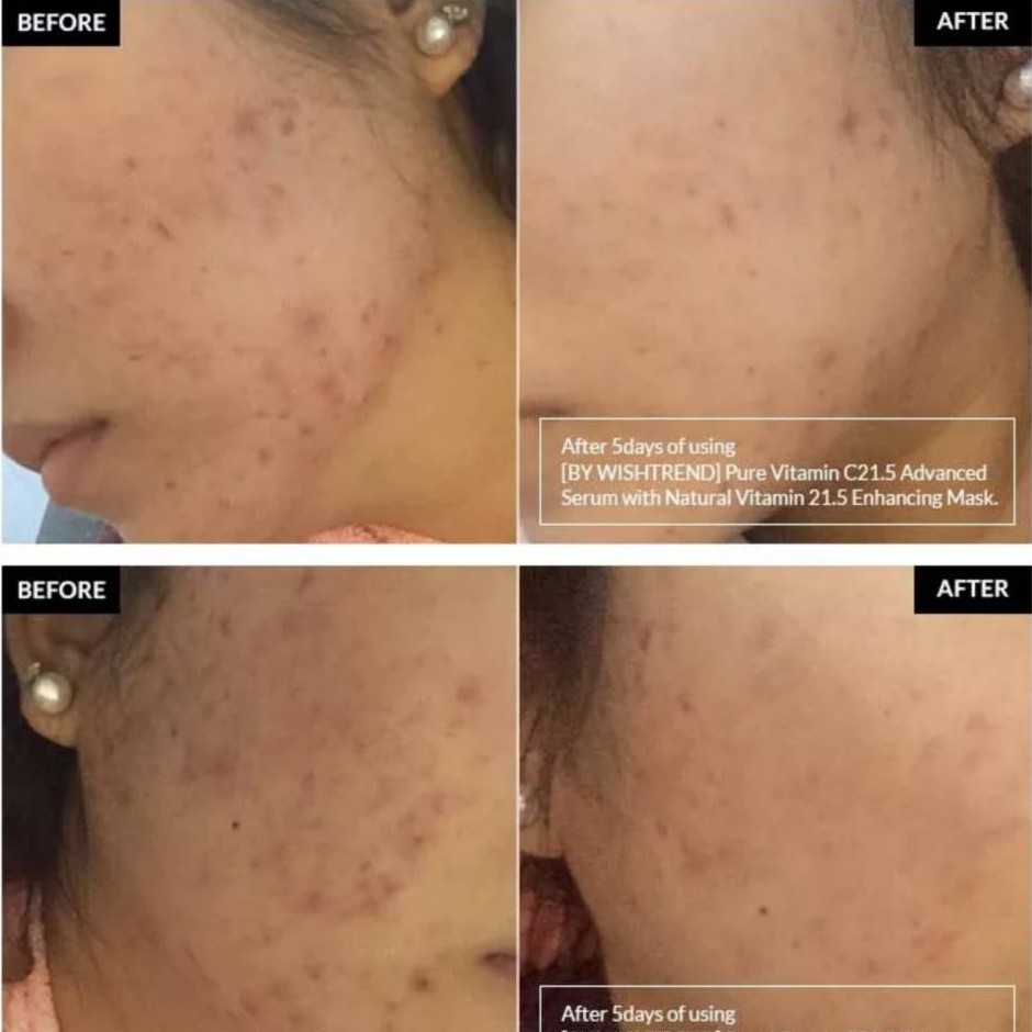 Tinh Chất Làm Mờ Mụn Thâm - Dưỡng Trắng Da By Wishtrend Pure Vitamin C 21.5 Advanced Serum | BigBuy360 - bigbuy360.vn