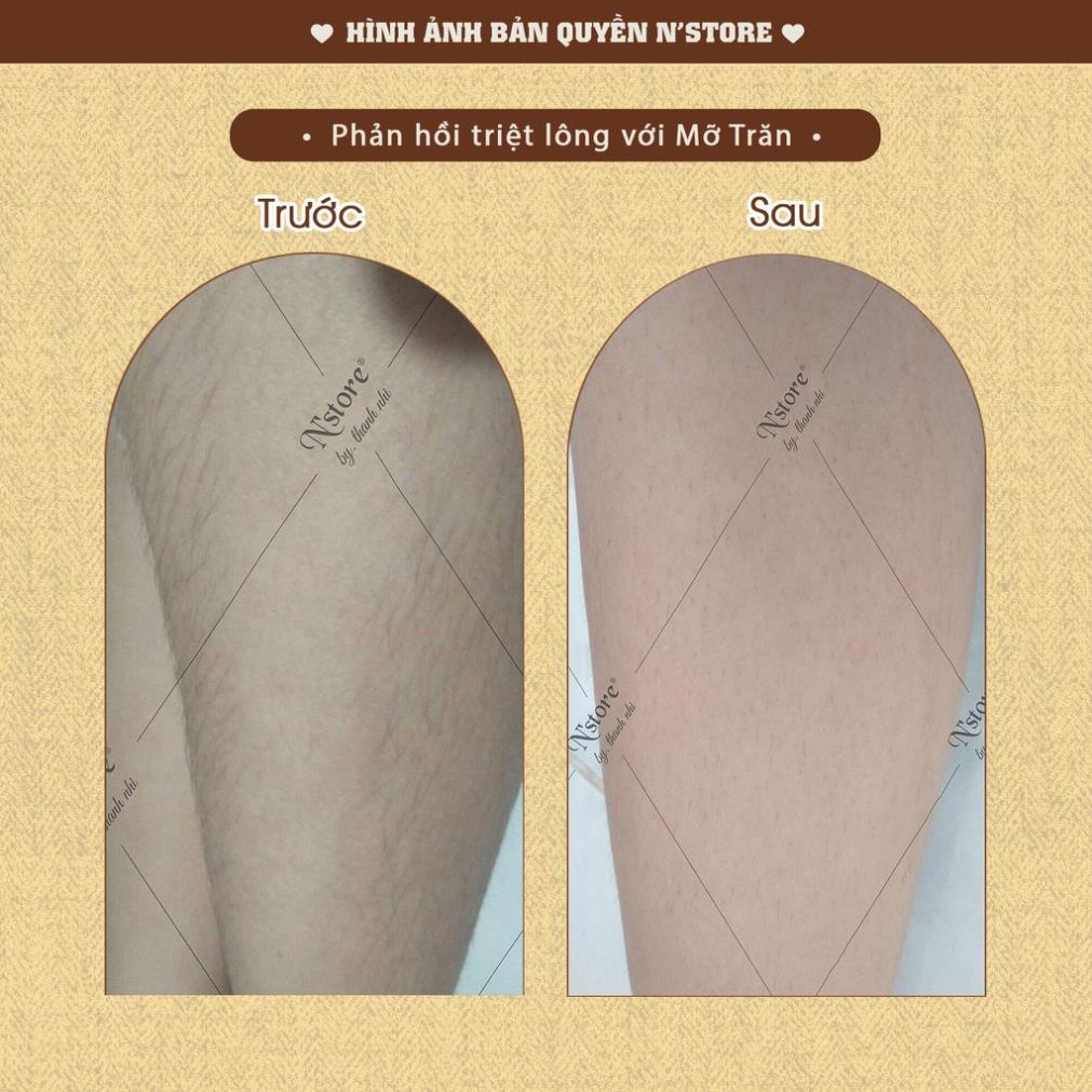 Mỡ Trăn Nguyên Chất N’store - triệt lông, mờ rạn da, dịu vết bỏng, chống sẹo an toàn tại nhà 75gr | BigBuy360 - bigbuy360.vn
