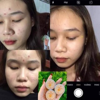 Cao mụn sâm đỏ MEEA ORGANIC mini size 15gr