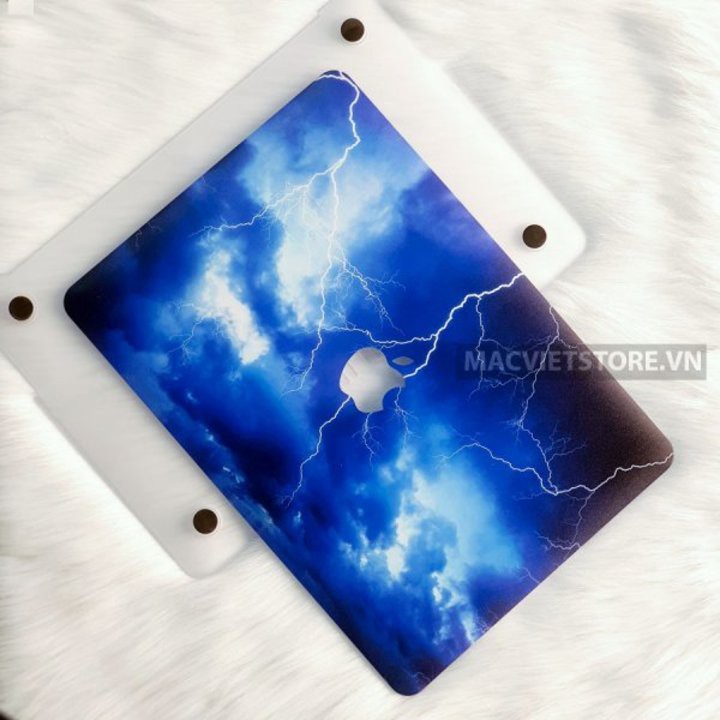 Ốp Macbook Hình Tia Sét Xanh Đủ Dòng (Tặng Kèm Phủ Phím Và Set Nút Chống Bụi) | BigBuy360 - bigbuy360.vn