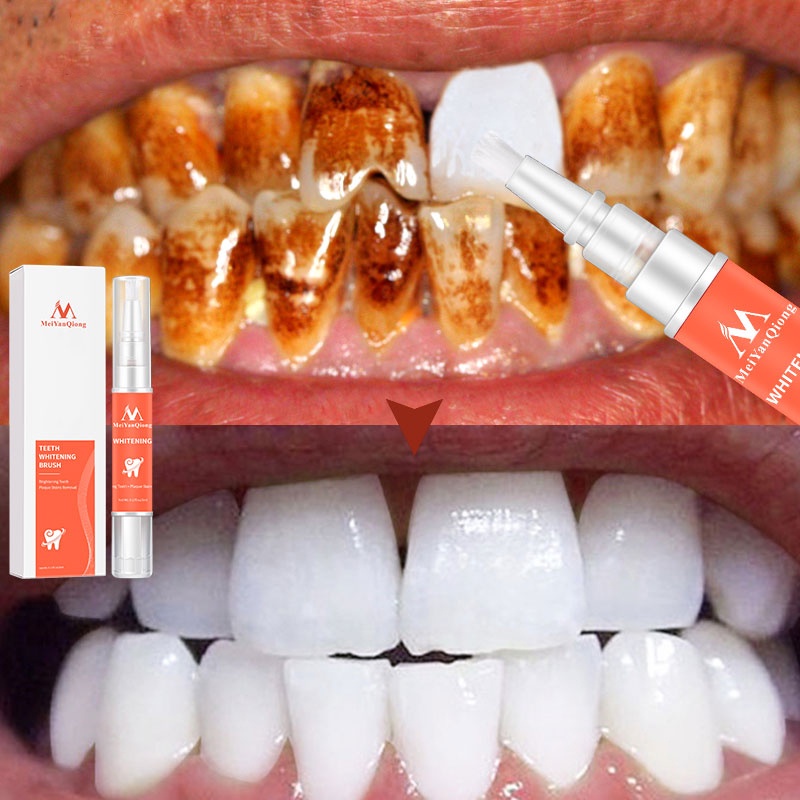 Bút Gel làm trắng răng Kem đánh răng loại bỏ vết bẩn chất lượng cao loại bỏ vết bẩn hàm răng trắng khỏe