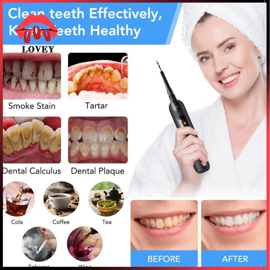 [Hàng mới về] Máy cạo vôi chăm sóc răng miệng chạy bằng điện dùng tại nhà