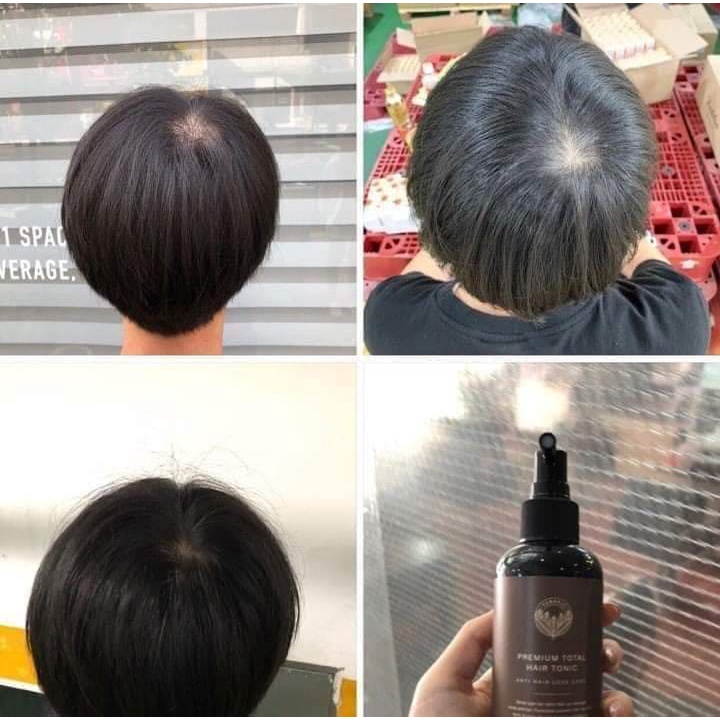Tinh Dầu Kích Thích Mọc Tóc Terapic Premium Total Hair Tonic 160ml Từ Nhiên Thiên, An Toàn Cho Sức Khỏe
