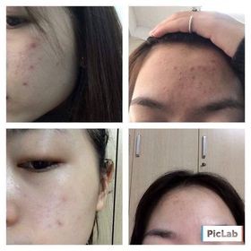 Sữa rửa mặt La Roche Posay