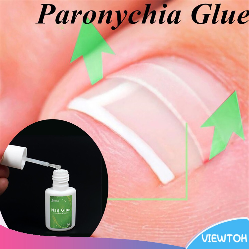 Keo dán điều chỉnh móng chân chuyên dụng 8g