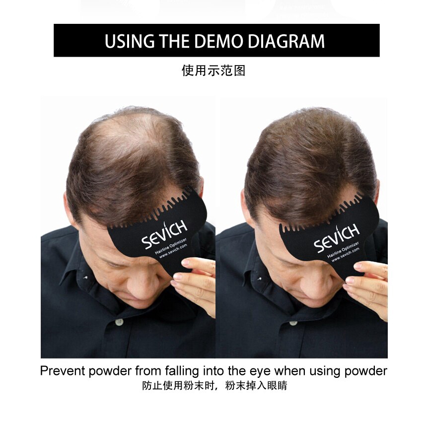 Lược chải tóc Keratin mát xa da đầu tiện dụng SEVICH