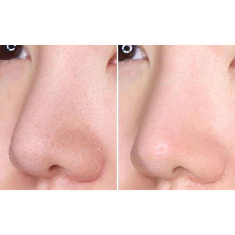 Miếng dán lột mụn đầu đen HATHERINE Pore Clear Black/ White/ Teatree Nose Strip