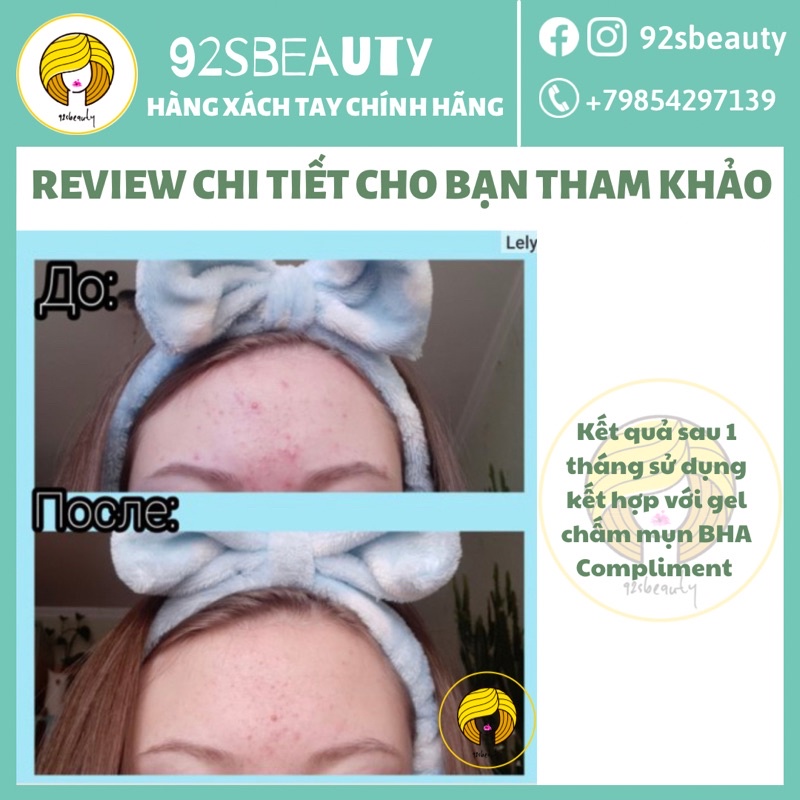 Toner Compliment No Problem làm sạch sâu, kiềm dầu, giảm viêm, giảm mụn