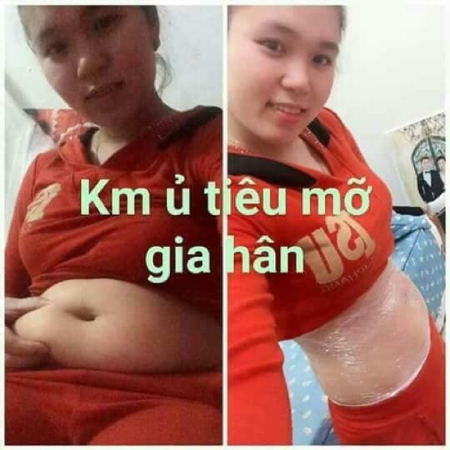 Kem ủ tiêu mỡ gia hân