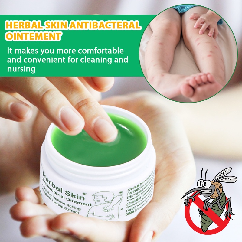 Kem bôi ngứa, người lớn, trẻ em, tinh chất thảo dược thiên nhiên