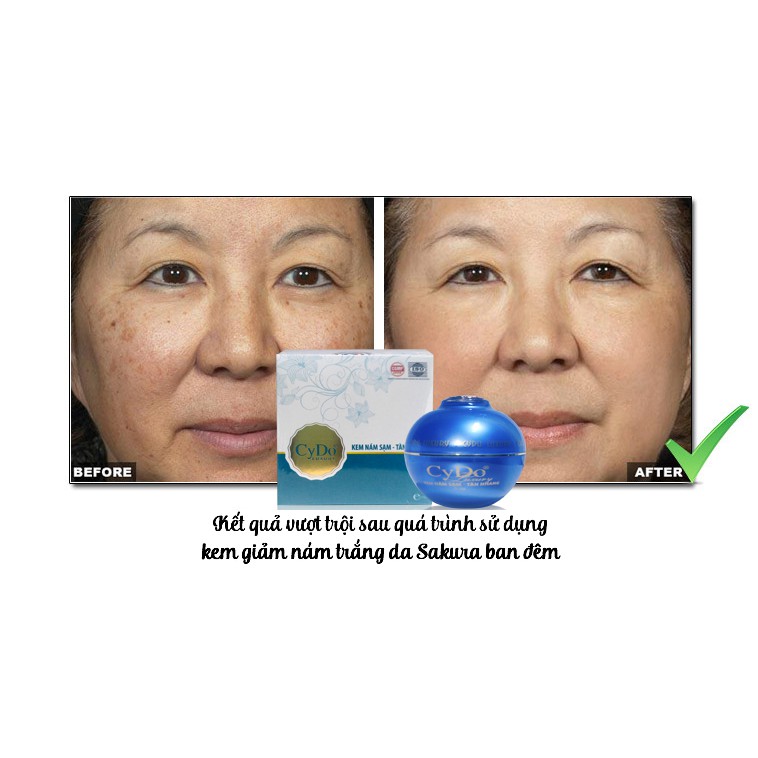 Kem Nám ,sạm,tàn nhang Luxury CyDo 16g-Chính Hãng