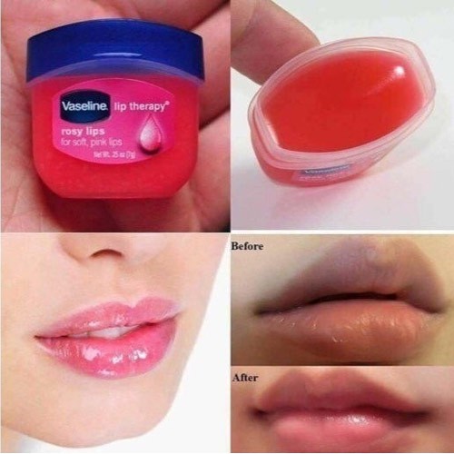 Son Dưỡng VASELINE Lip Therapy Dưỡng Môi Mềm Mịn ( Hủ 7g )