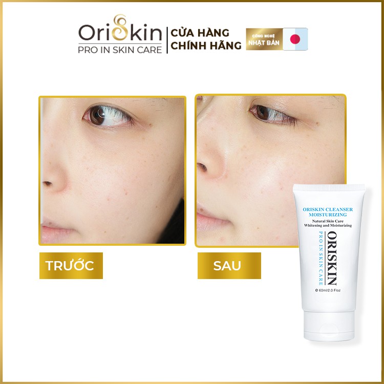 Sữa Rửa Mặt Trắng Da Oriskin Cleanser Moisturizing, Ít Bọt Dành Cho Da Nhạy Cảm.