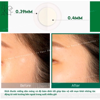 Miếng Dán Mụn Some By Mi Clear Spot Patch