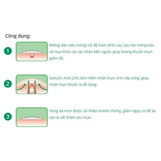 Miếng Dán Mụn Kháng Khuẩn, Sạch Mụn Acnes Clear Patch (24 Miếng)