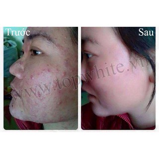 Sữa Rửa Mặt Top White D5