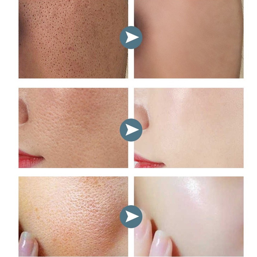 Se Khít Lỗ Chân Lông Kiểm Soát Dầu Chống Lão Hóa Làm Trắng Sáng Da 10ml