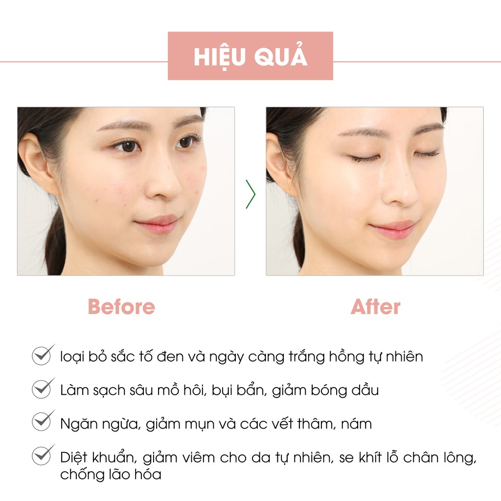 Bộ Truesky VIP04 gồm 1 gel rửa mặt 50g + 1 kem dưỡng trắng da mặt 20g + 1 kem ủ trắng 100g + 1 kem dưỡng trắng 100g | BigBuy360 - bigbuy360.vn