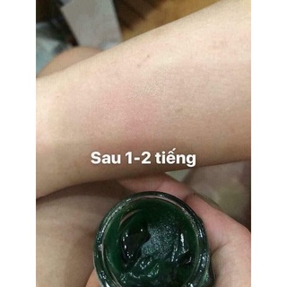 CAO BÔI MUỖI ĐỐT THÁI LAN