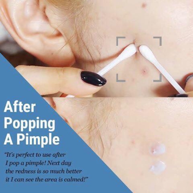  Kem Dưỡng Da Phục Hồi Klairs Midnight Blue Calming Cream | BigBuy360 - bigbuy360.vn