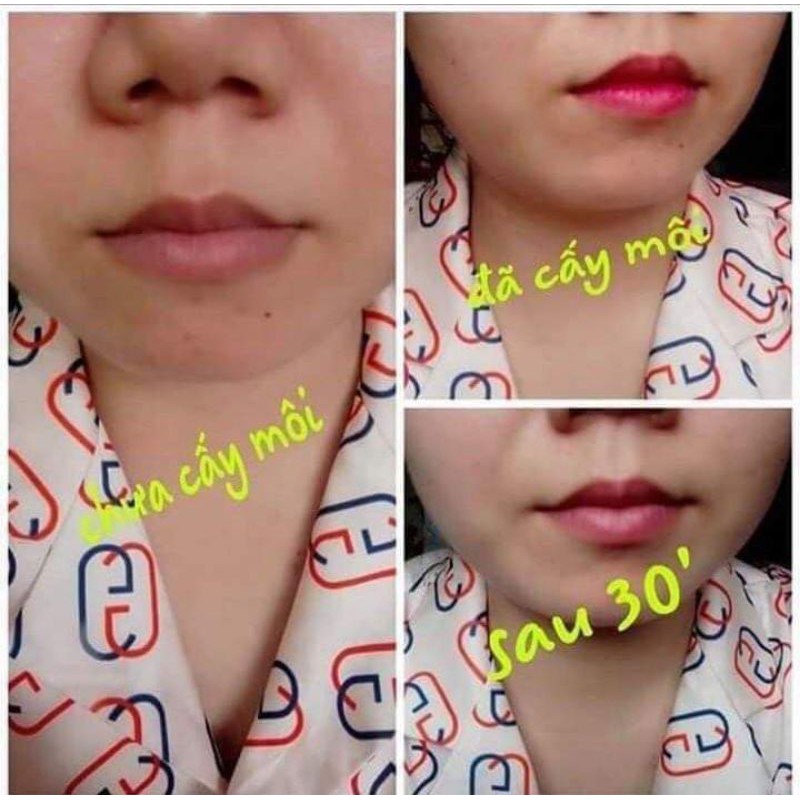 [Freeship] Cấy môi vaura, cấy màu môi babier lips volume | BigBuy360 - bigbuy360.vn