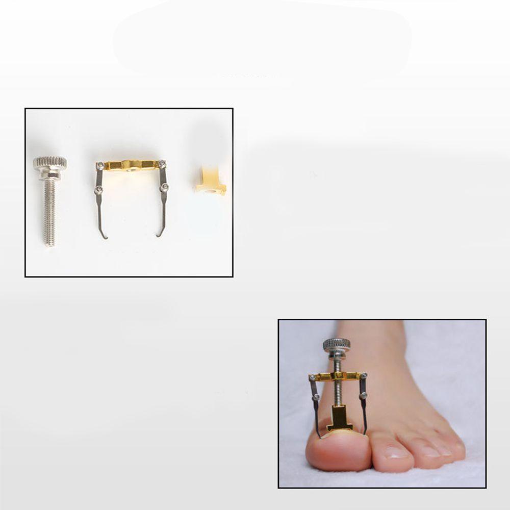Dụng Cụ Chỉnh Sửa Móng Chân Mọc Ngược Hiệu Quả Bằng Thép Không Gỉ