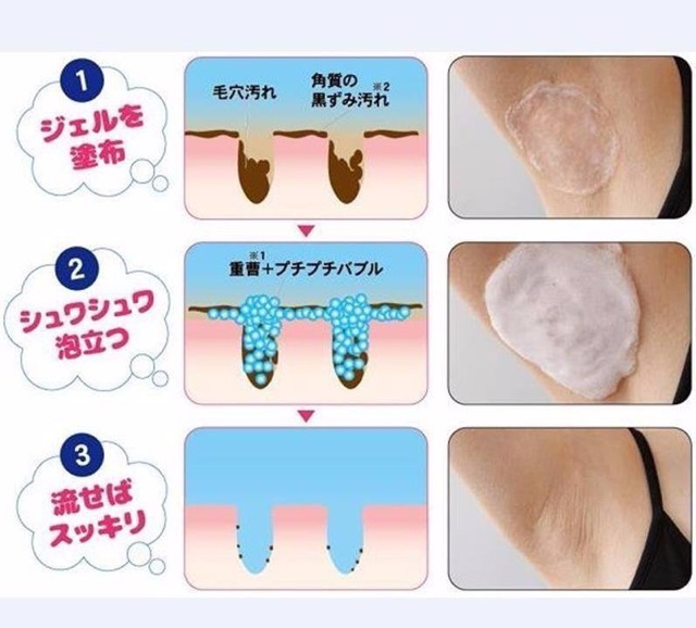 XÀ PHÒNG GIẢM THÂM NÁCH , KHUỶ TAY PELICAN | BigBuy360 - bigbuy360.vn