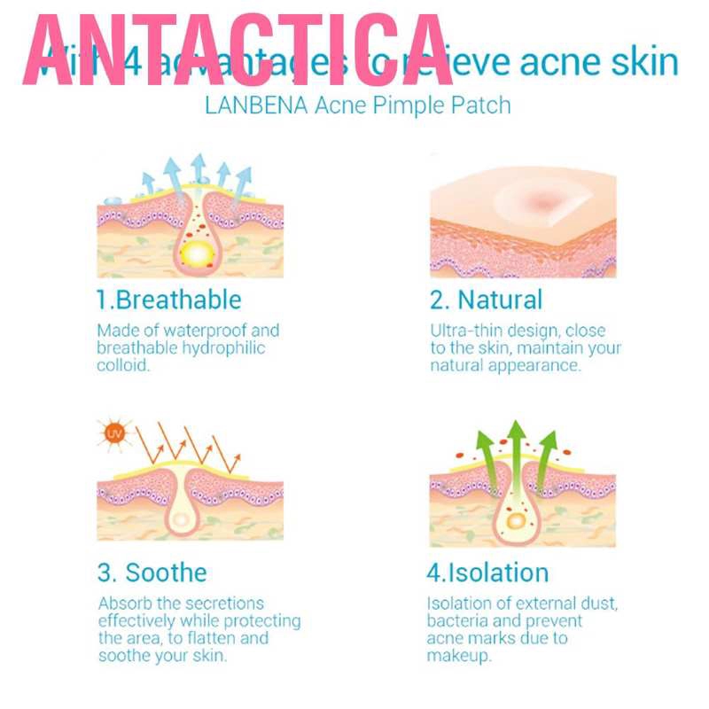 Set 36 Miếng Dán Che Mụn Chống Thấm Nước Thoáng Khí | BigBuy360 - bigbuy360.vn