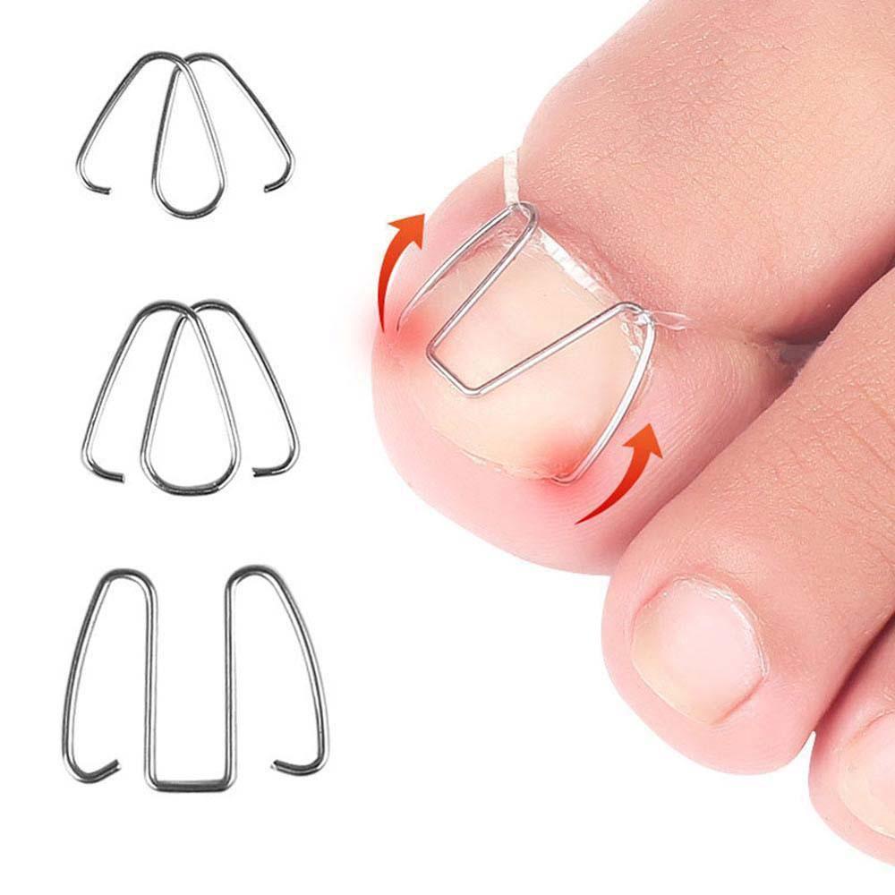 1 Hộp Dụng Cụ Cố Định Móng Chân Bằng Thép Không Gỉ