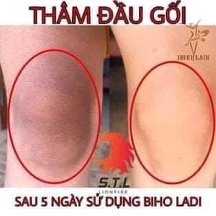 BIHO LADI Siêu Dưỡng Thâm 5S, Hương Thơm Nhẹ, Giảm Thâm Bụng, Kem Làm Mờ Vết Thâm Nách, Mông, Bikini, Nhũ Hoa (biholady) | BigBuy360 - bigbuy360.vn