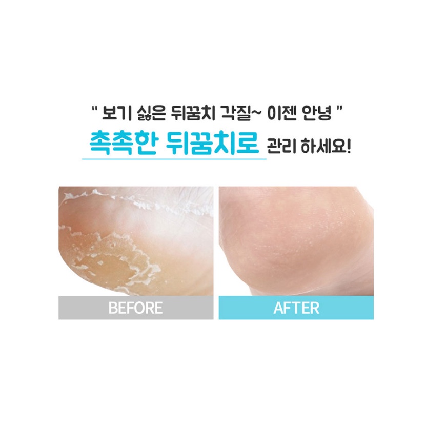Set 2 bộ mặt nạ tẩy da chết gót chân Purederm Exfolaiting Heel Mask