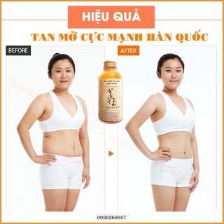 Gel Tan Mỡ Cấp Tốc Hàn Quốc Tặng Đai Nịt Bụng