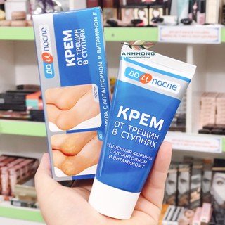 Kem Dưỡng Nứt Gót Chân Nga Kpem