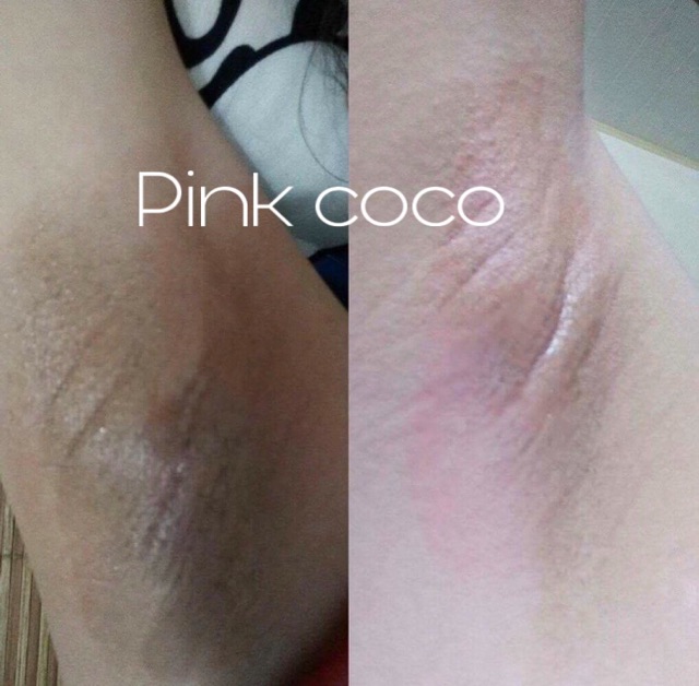 ✅  - Pink coco, Kem làm hồng nhũ hoa và vùng kín, ngừa thâm của Mỹ
