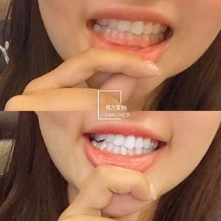 Kem Đánh Răng Median Dental IQ 93% Toothpaste