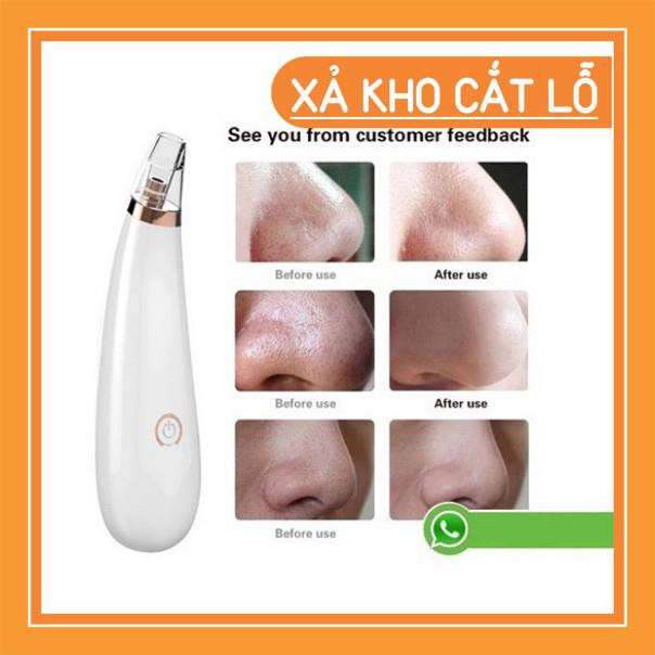 [ RẺ VÔ ĐỊCH] MÁY HÚT MỤN MINI CẦM TAY CAO CẤP 3 CHẾ ĐỘ HÚT, SẠCH MỤN CÁM, MỤN ĐẦU ĐEN, LÀM SẠCH LỖ CHÂN LÔNG | BigBuy360 - bigbuy360.vn
