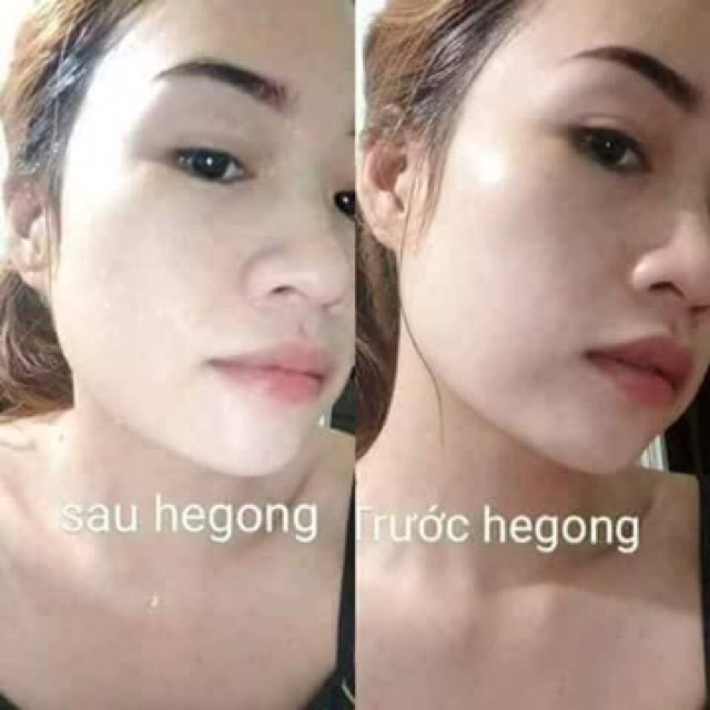 Ủ face hegong