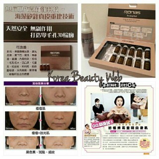 [tách lẻ 1 cặp] Vi kim tảo Ronas