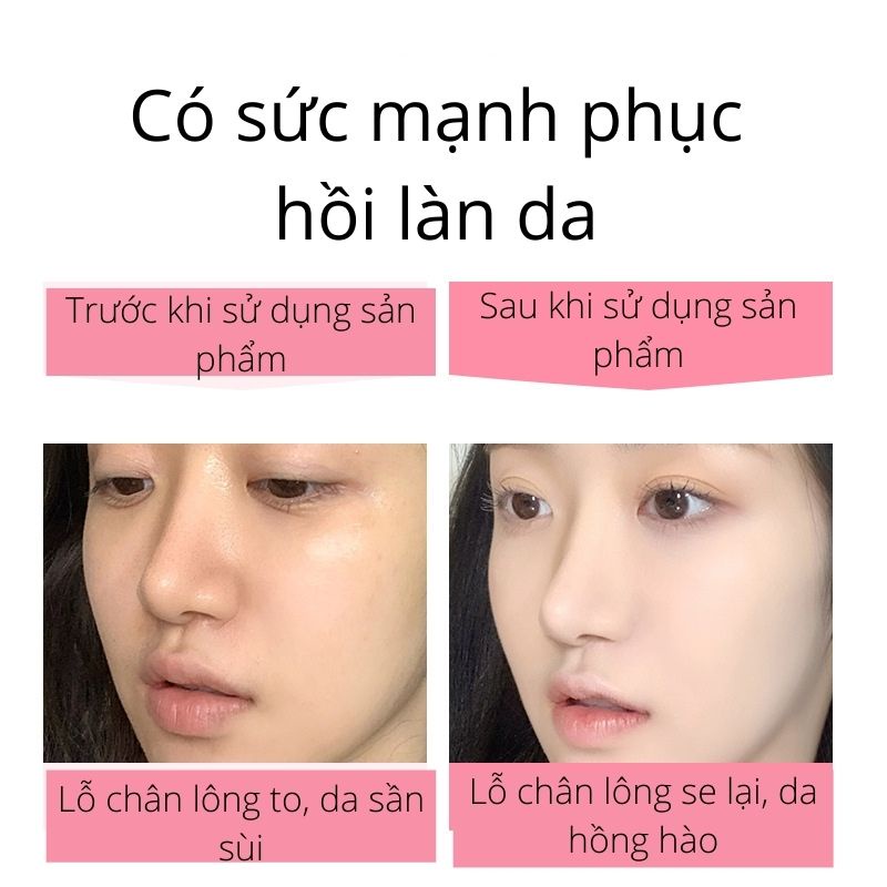 Kem lót che khuyết điểm thu nhỏ lỗ chân lông kiềm dầu NORO-Baihee | BigBuy360 - bigbuy360.vn