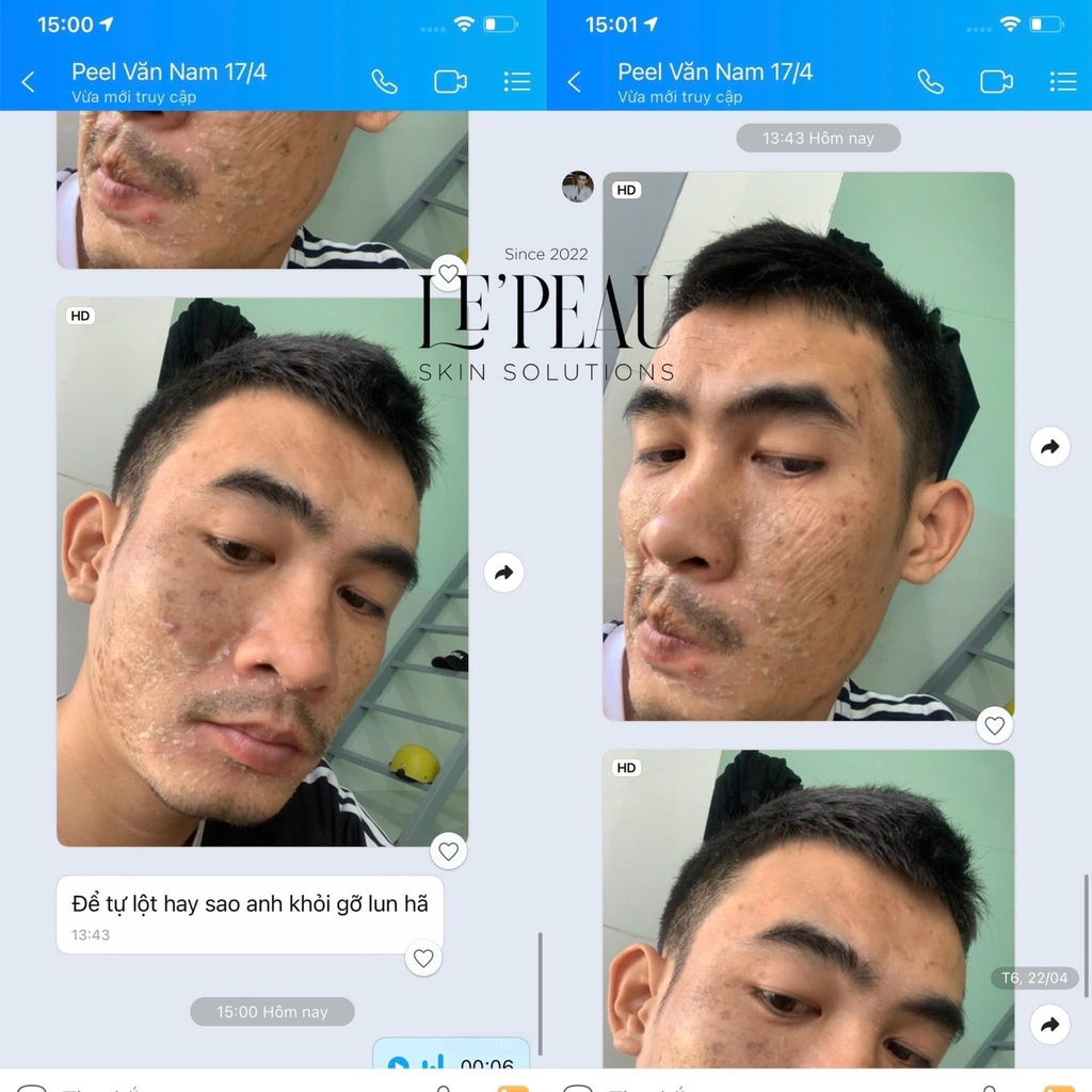 Peel Da Retinol Vi Tảo LE PEAU, Tinh Chất Tái Tạo Da Sinh Học Căng Bóng, Tặng Kèm Serum B5 Phục Hồi - 10ml