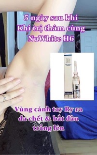 Tinh chất làm hồng nhũ hoa