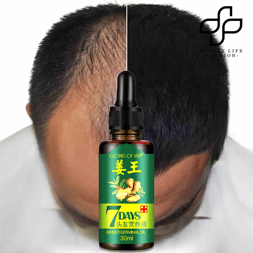 (Hàng Mới Về) Tinh Dầu Gừng Kích Thích Mọc Tóc Nhanh Trong Vòng 7 Ngày