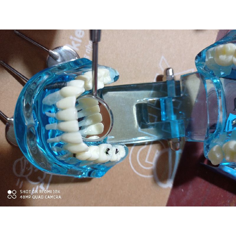 12 chiếc mặt gương rời chuẩn parkistan