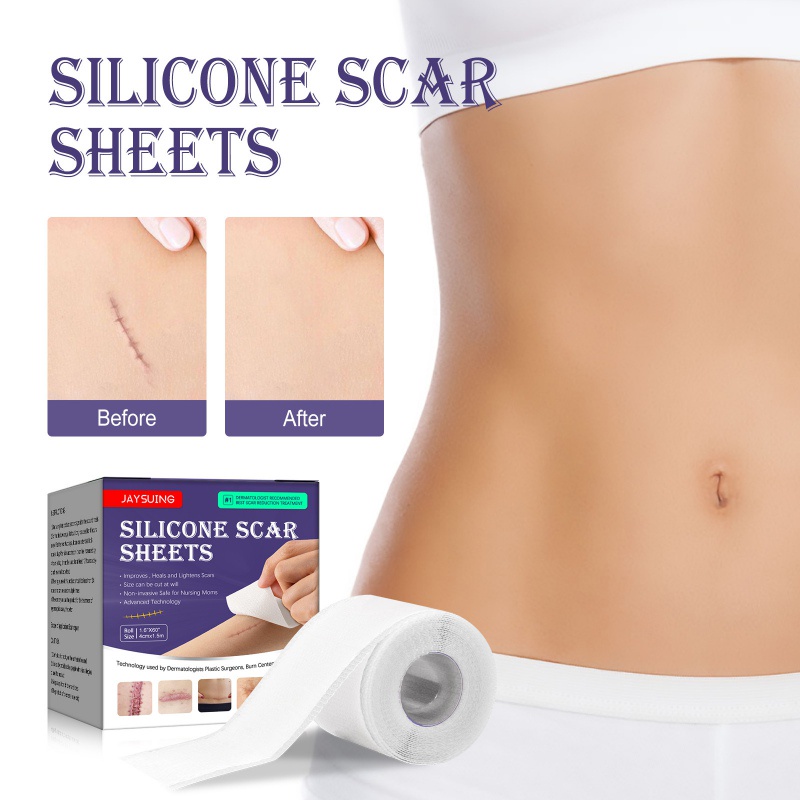 1 Cuộn Băng Dán Hỗ trợ giảm sẹo Bằng Silicone Tiện Dụng