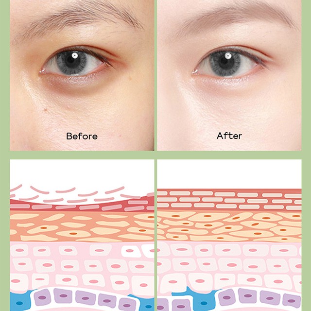 Kem Dưỡng Da Mắt Fenyi EYE CREAM Green Tea Chiết Xuất Trà Xanh Giảm Bọng Mắt 15g | BigBuy360 - bigbuy360.vn